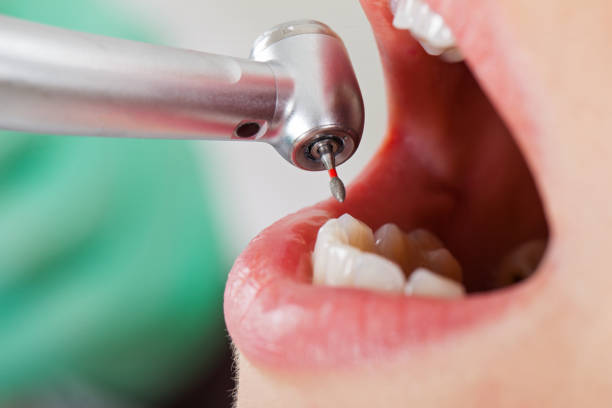 Best Broken Tooth Emergency  in Naples Manor, FL